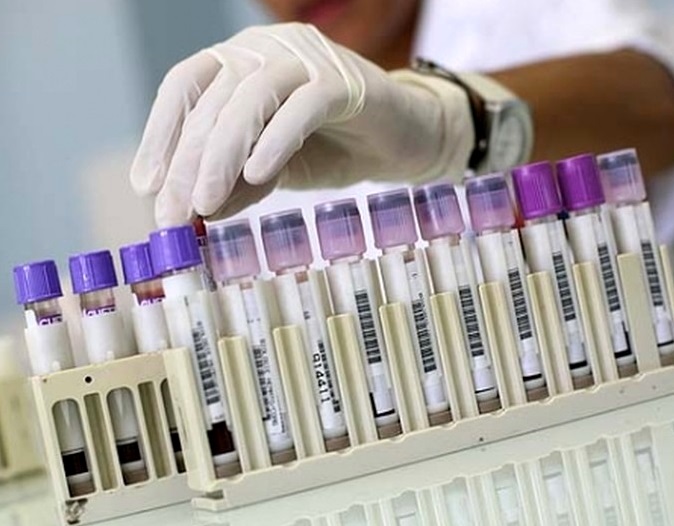 21_10_2020r_statistika-koronavirus.jpg