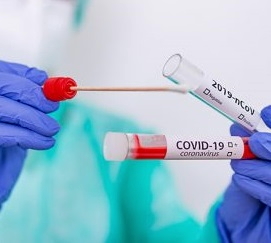 Covid-19-1-300x300.jpg