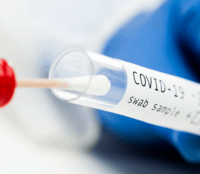 Day-2-and-Day-8-RT-PCR-test-1statistika-koronavirus-15_09_2021.png