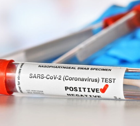 UKRI-080121-CoronavirusTestConcept-GettyImages-1220397974-735x490.jpg