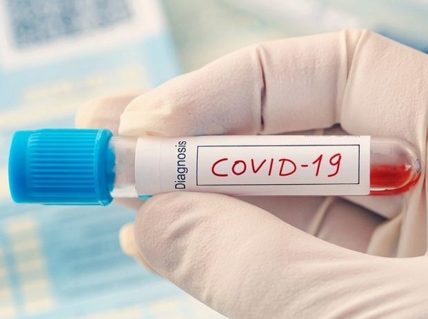 covid-19-u-ternopoli-stanom-na-17-lipnya-2020-roku