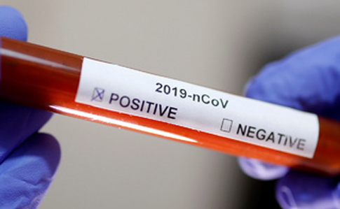 koronavirus-08-06-2020
