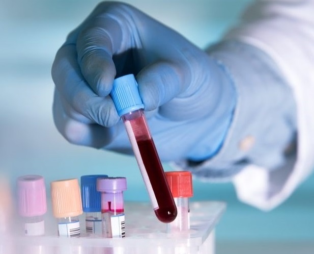 koronavirus-stanoi-na-08_07_2021.jpg