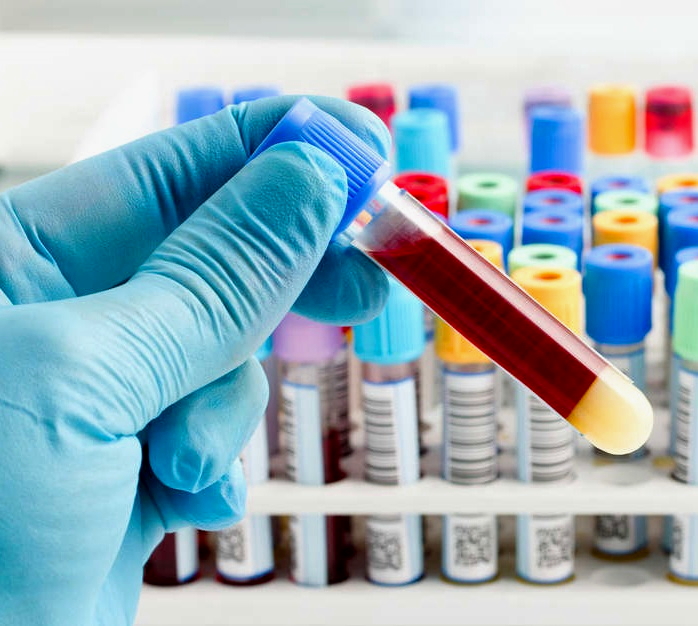 quantiferon-tb-testing-312021.jpg