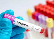 staitistika-koronavirus-21_012021.jpg
