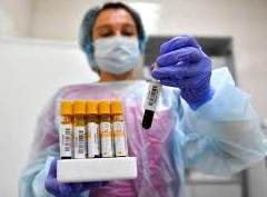 statistika-koronavirus--12_01_2021