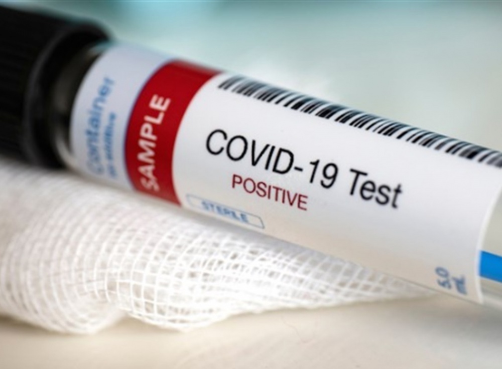 statistika-koronavirus--2_12_2020r_.jpg
