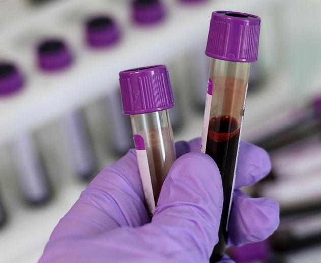 statistika-koronavirus-03_06_2021