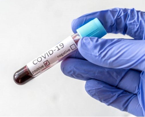 statistika-koronavirus-04_02_2021r_