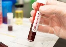 statistika-koronavirus-04_12_2020r_.jpg