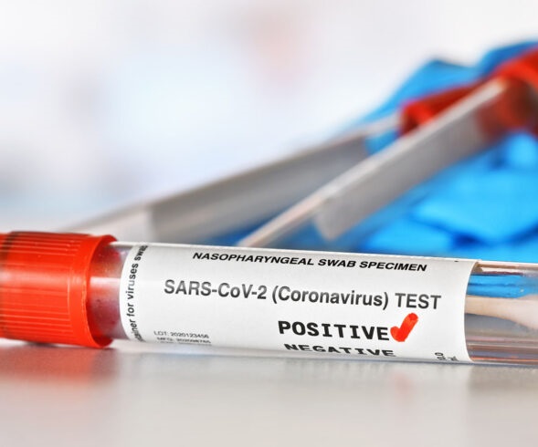 statistika-koronavirus-07_08_2021.jpg