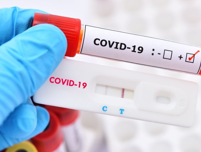 statistika-koronavirus-08_12_2020r_.jpg