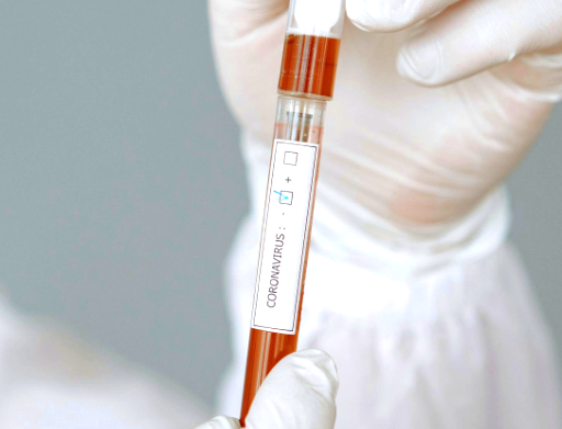 statistika-koronavirus-10_02_2021r_.png