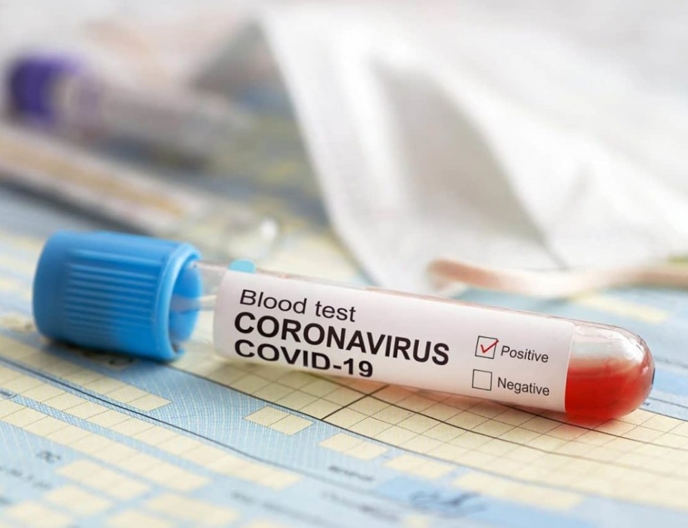 statistika-koronavirus-12_11_2020r_.jpeg