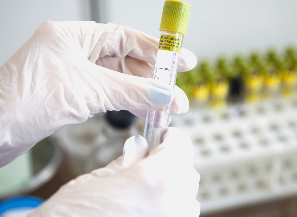 statistika-koronavirus-13_11_2020r_.jpg