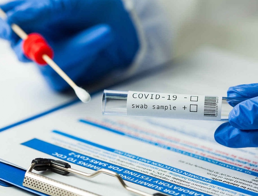 statistika-koronavirus-154_01_2021