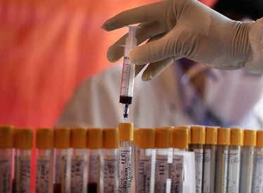 statistika-koronavirus-16_11_2020roku.jpg