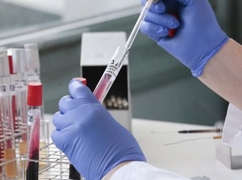 statistika-koronavirus-18_01_2021.jpeg