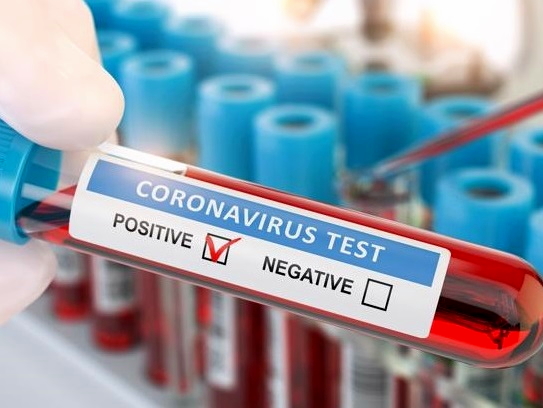 statistika-koronavirus-18_12_2020r_.jpeg