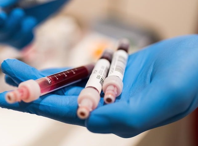 statistika-koronavirus-2020-30-grudnya.jpg
