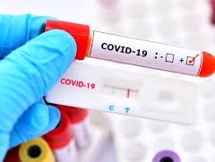 statistika-koronavirus-22_01_2021.jpg
