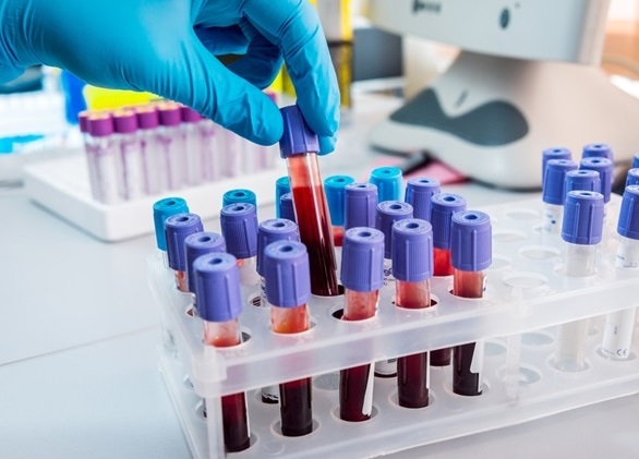 statistika-koronavirus-24-listopada-2020-roku.jpg