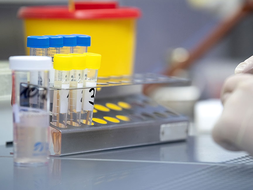 statistika-koronavirus-26_01_2021