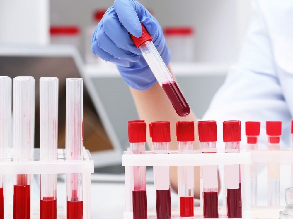 statistika-koronavirus-27_11_2020r_.jpg