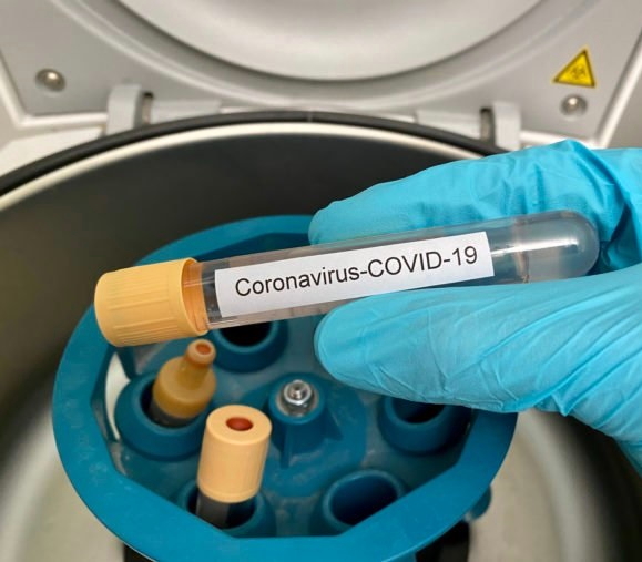 test-covid-676x507.jpg